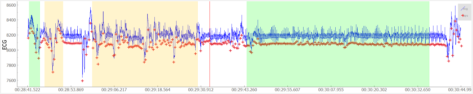 _images/example_intervals.png