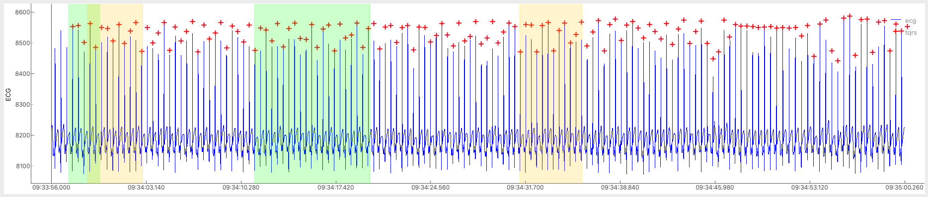 _images/example_interval.png